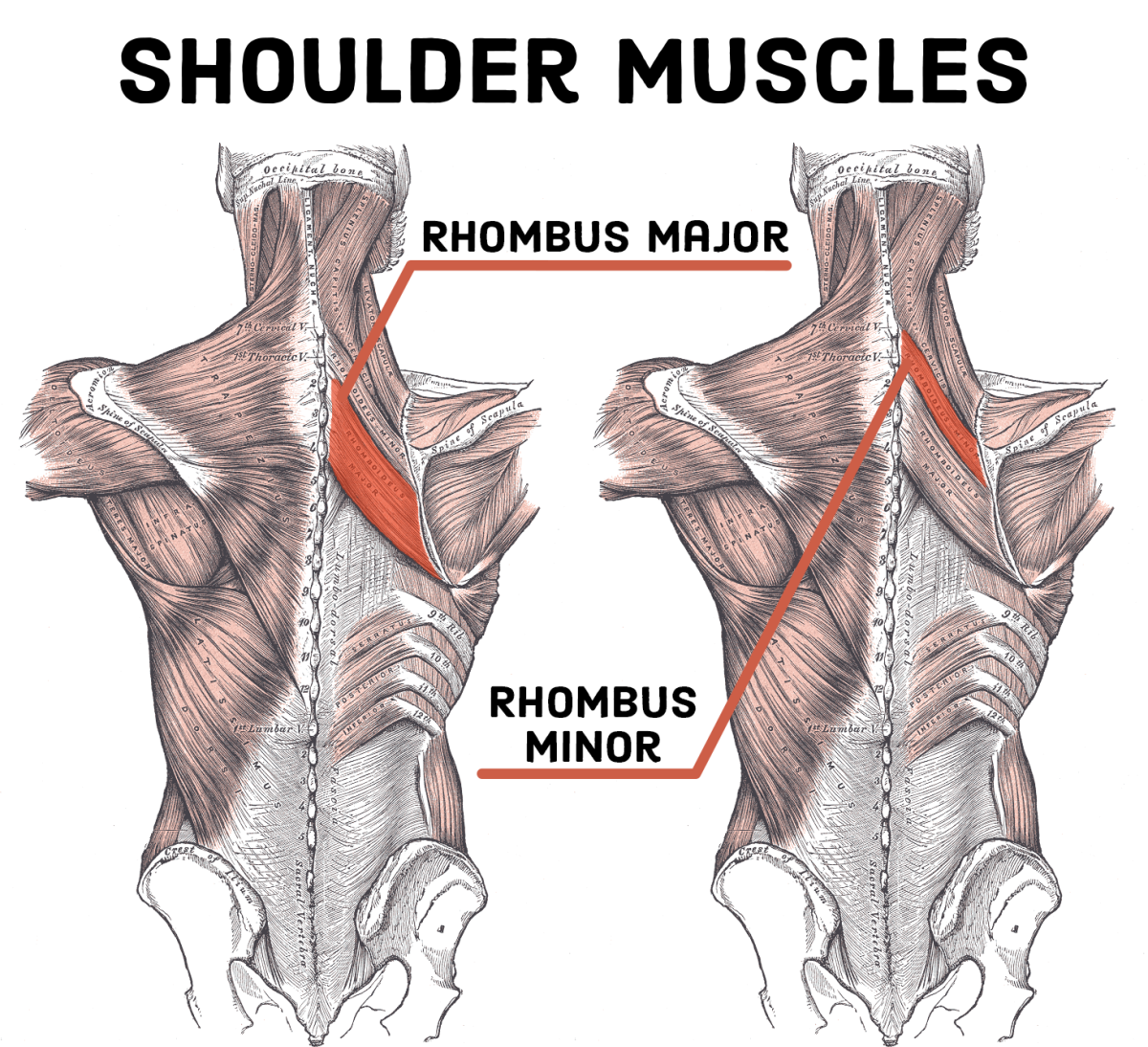 Sore Shoulder Blade Treatment 5 Stretches CalorieBee