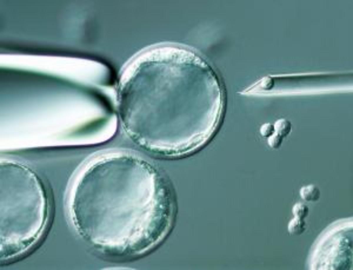 Human stem cells made using Dolly cloning technique.