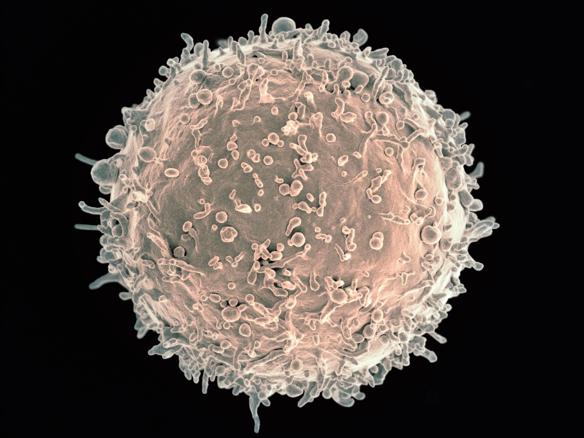 An example of a B cell or B lymphocyte viewed with a scanning electron microscope (colorized photo)
