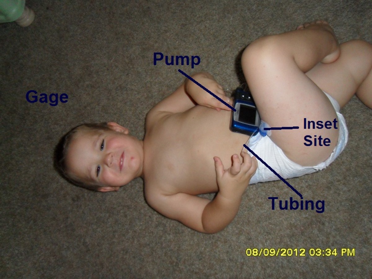 Gage's insulin pump