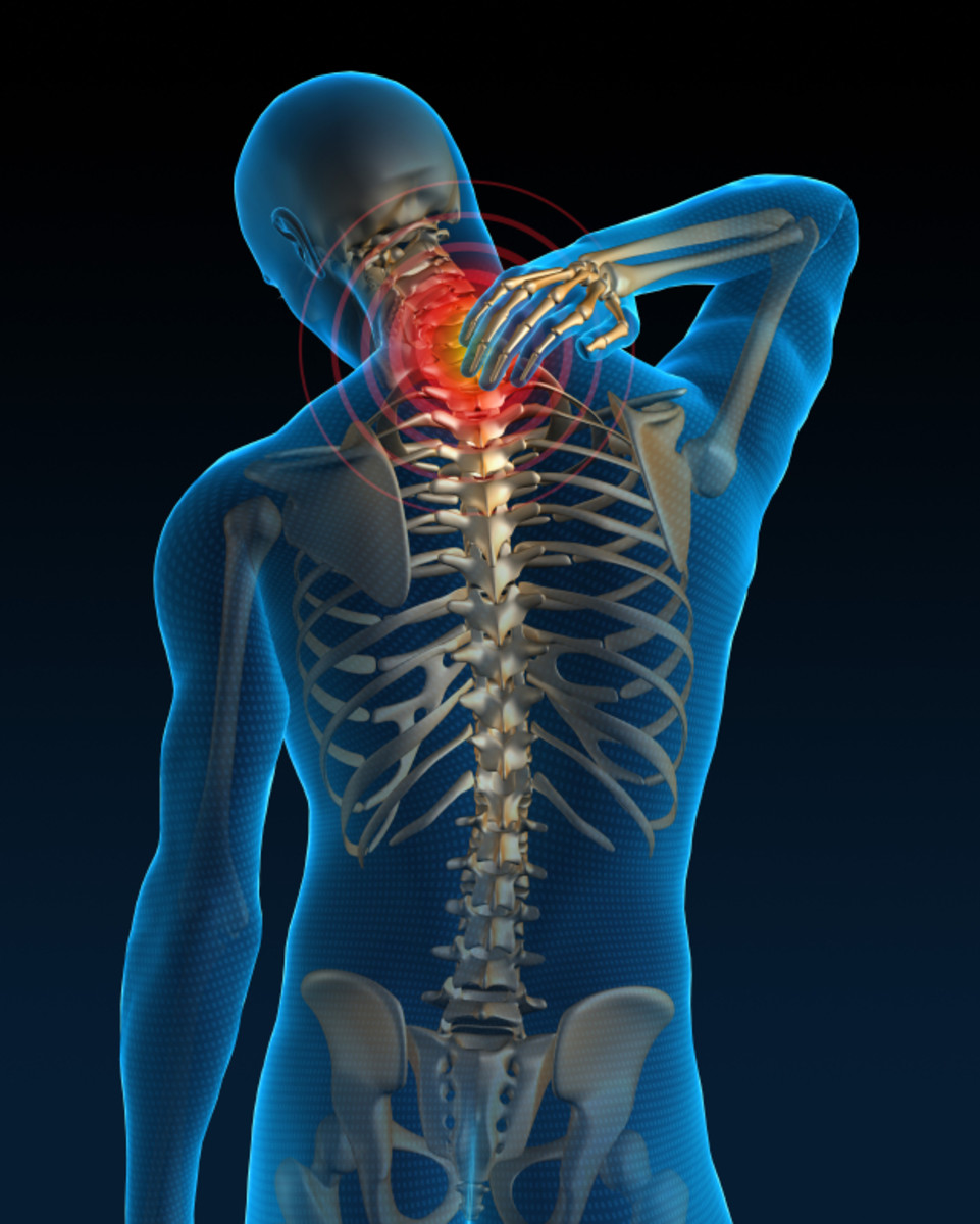 Neck Pain #9 – Cervical Spondylosis – Treatment 5 - Strengthening Exercises