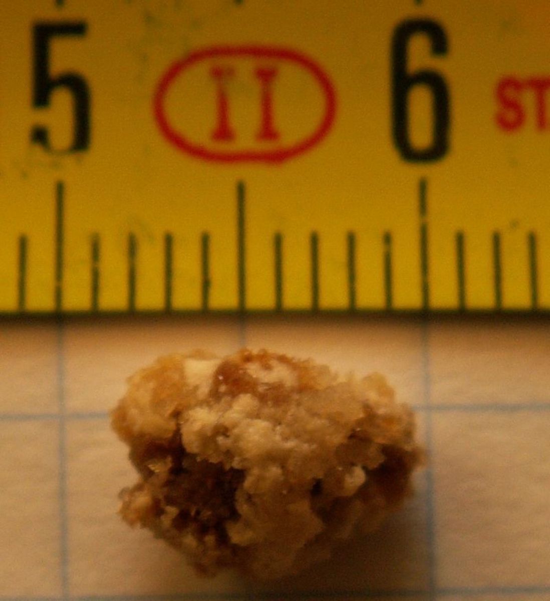 Alas, this is not Mel's beloved kidney stone, which has been long lost, but it is of the same 8mm size and approximate shape of his.