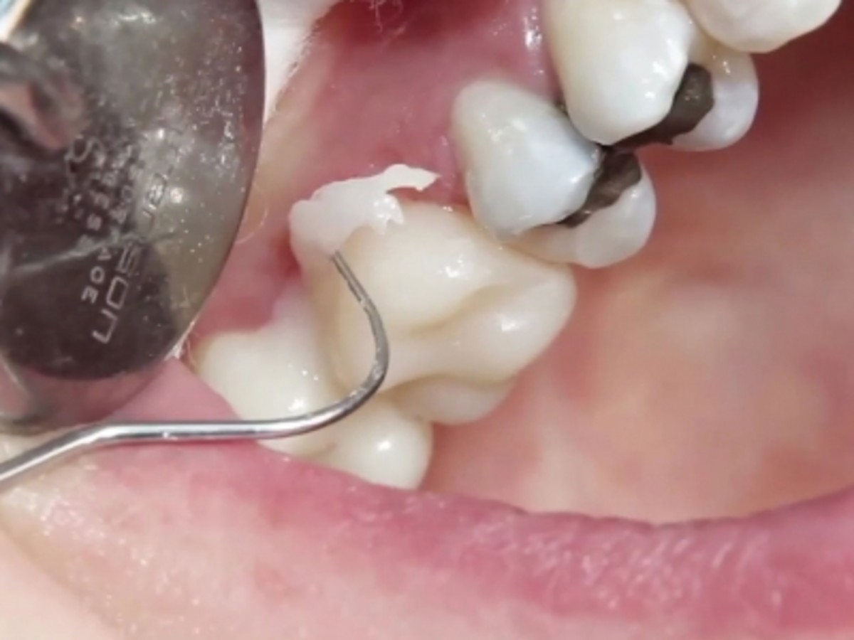 a-short-painful-history-of-dentistry