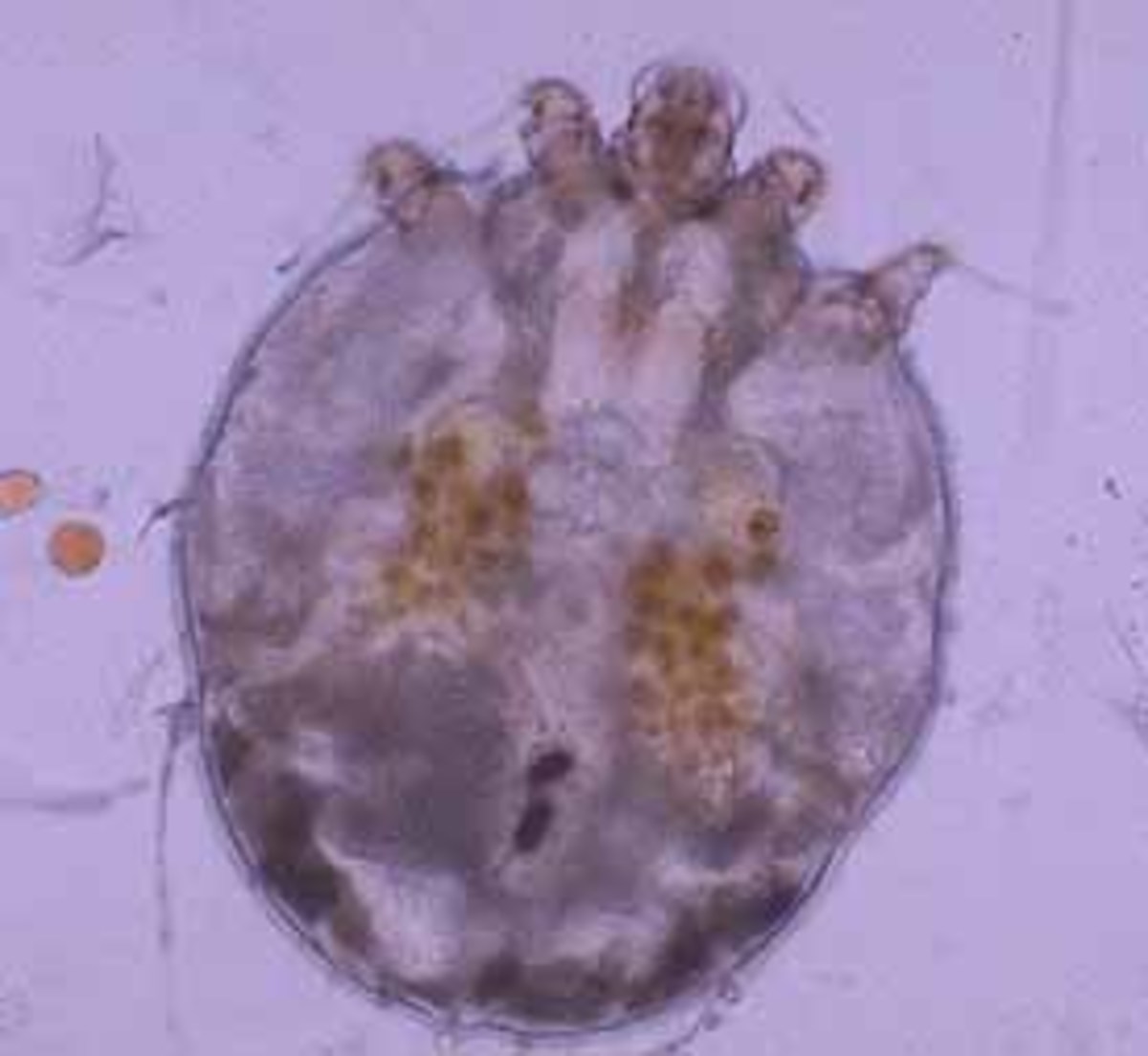 Parasite Sarcoptes scabiei which causes scabies