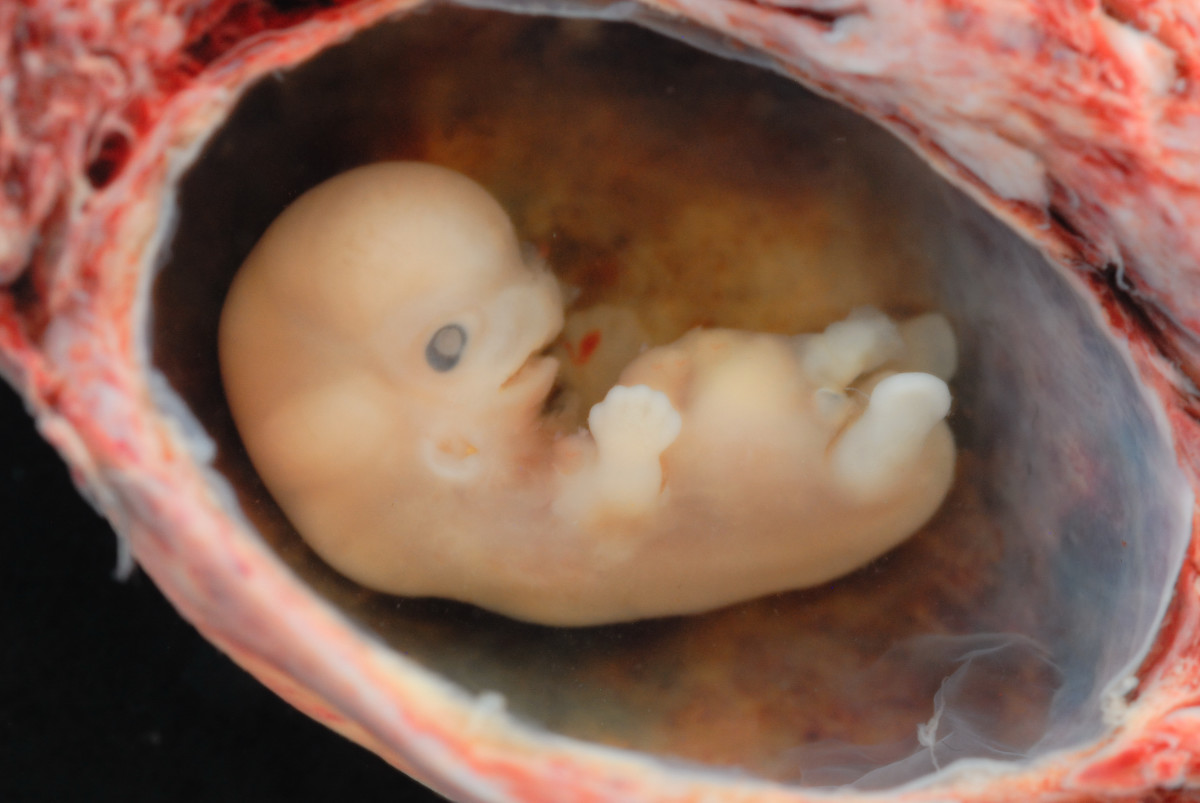 A human embryo at about eight weeks gestation. This is about the time of the first prenatal visit. The baby's heart is already beating, and you can already see the baby's eye, arms, and legs start to form. 