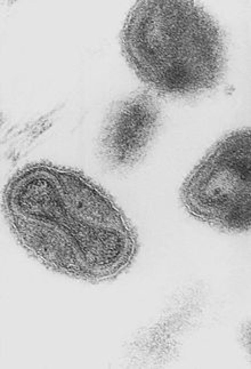 Variola virus