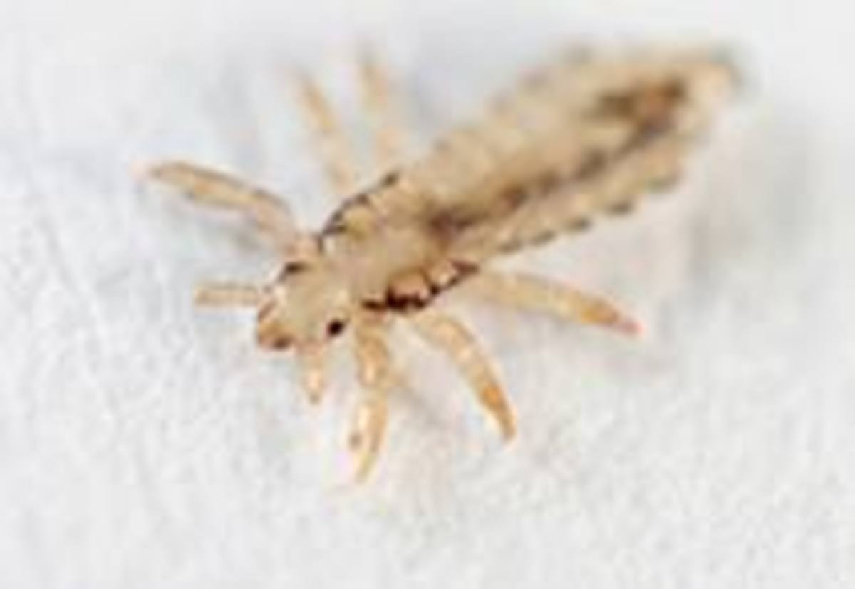 How do you get rid of head lice and nits and how to find lice.