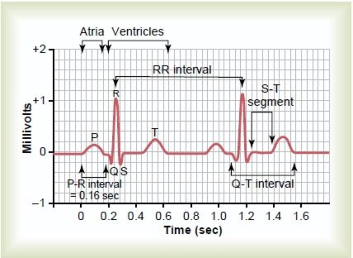 How To Read A Normal ECG Electrocardiogram HubPages