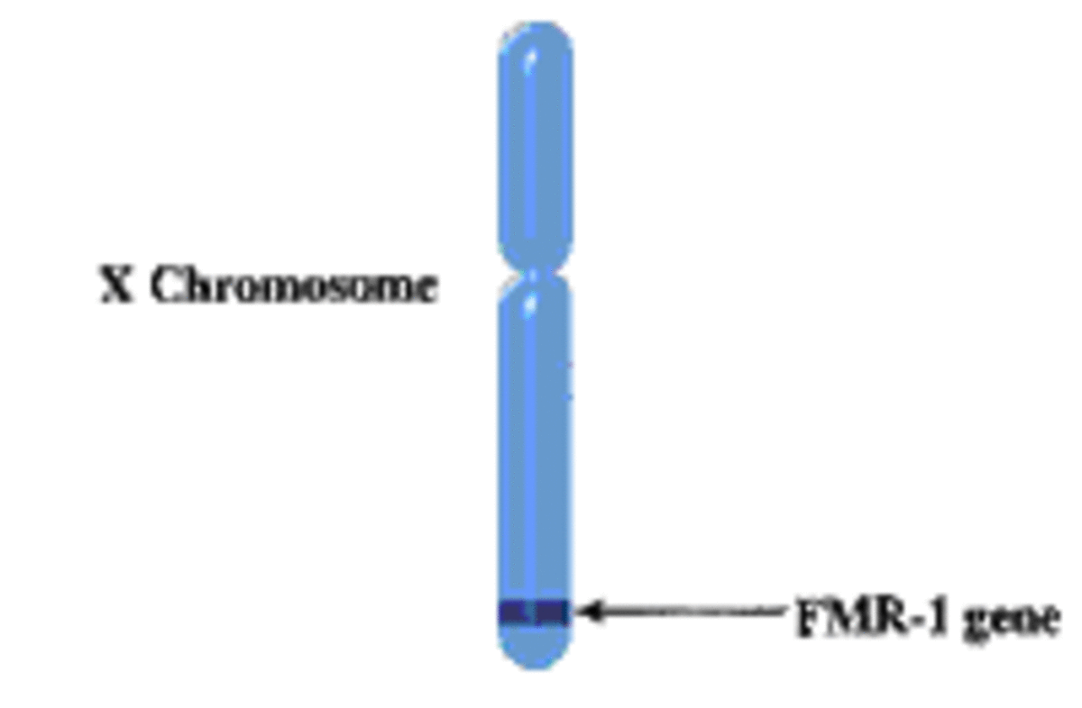 As this diagram shows the FMR1 gene is found at the tip of the X chromosome. 