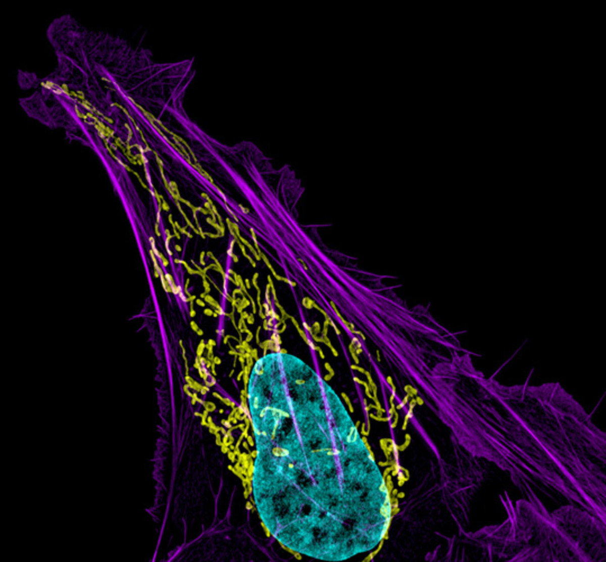 Osteosarcoma cell (bone cancer) showing actin filaments (purple), mitochondria (yellow), and DNA (blue) in an U2OS cell (63x)- NIGMS, NICHD, National Institutes of Health.