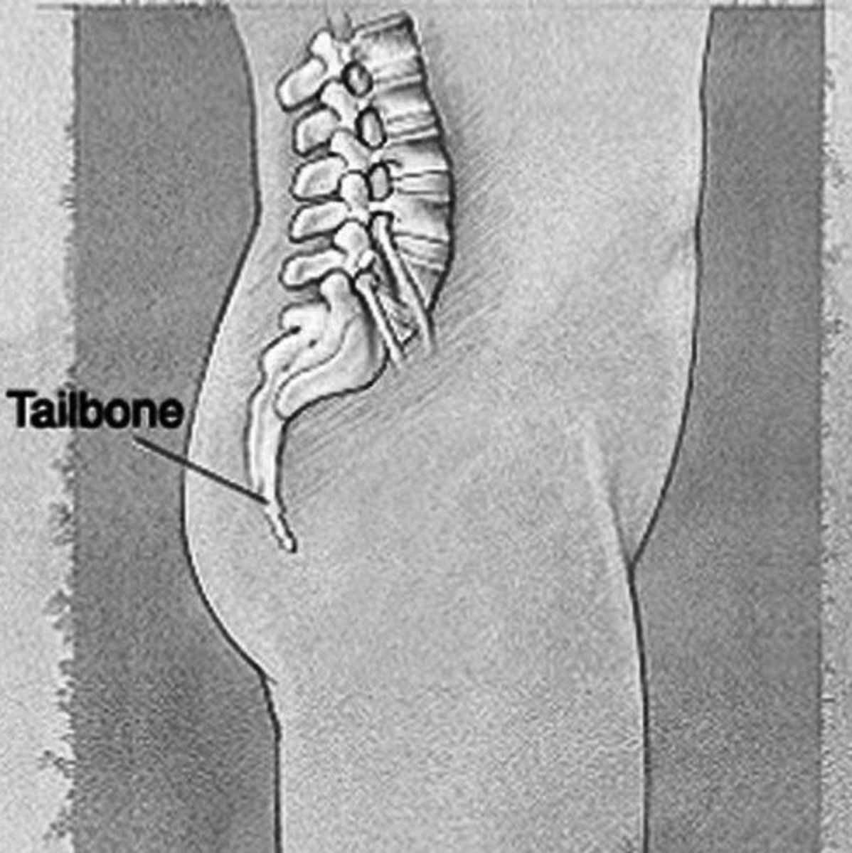 bruised-tailbone