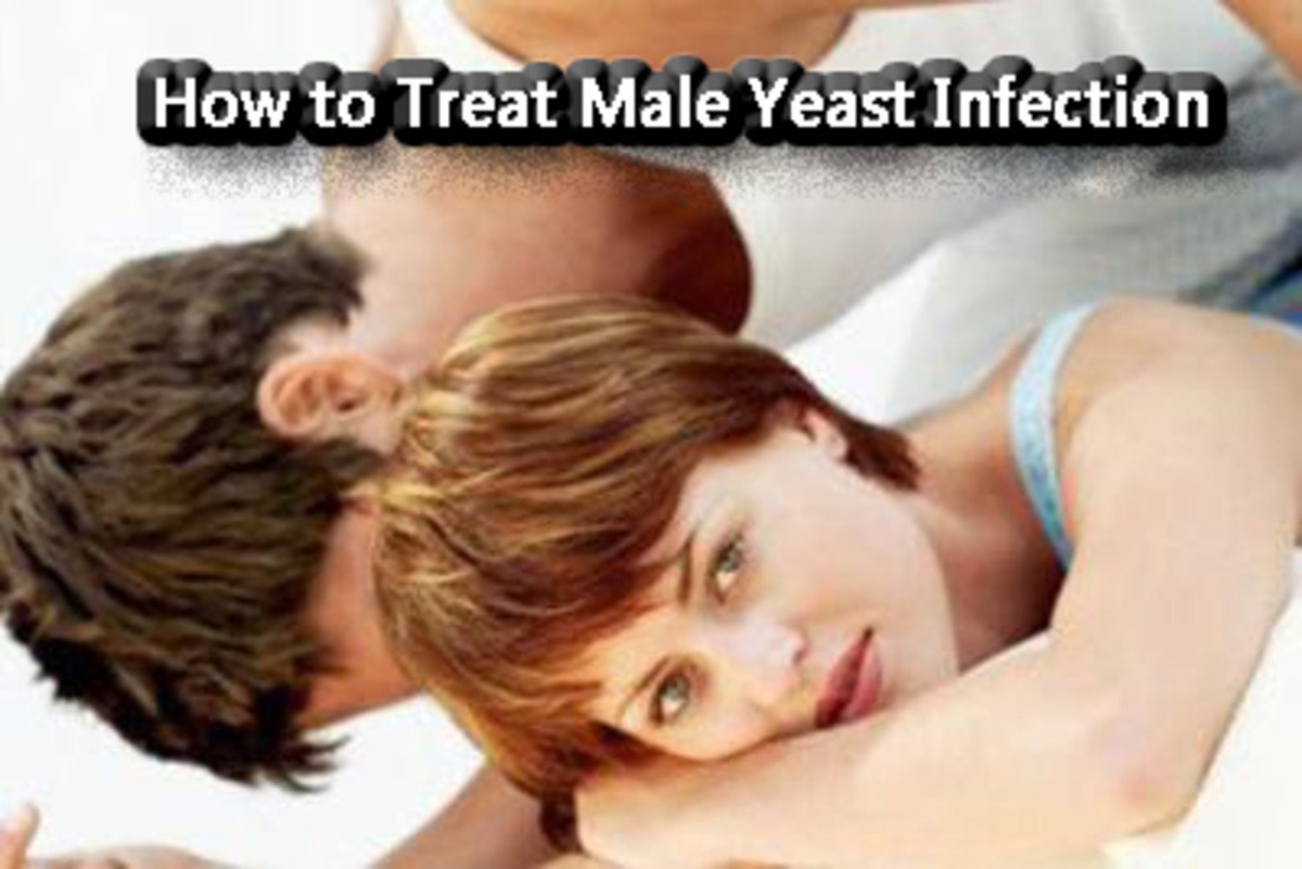 Men get yeast infections too. Treating a male yeast infection is easy by following these methods.