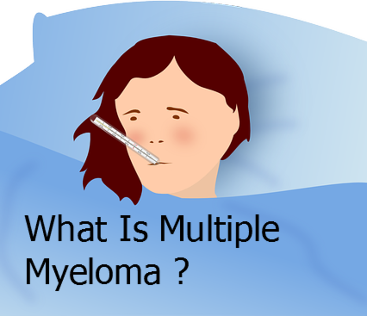 Multiple Myeloma Is a Type of Cancer