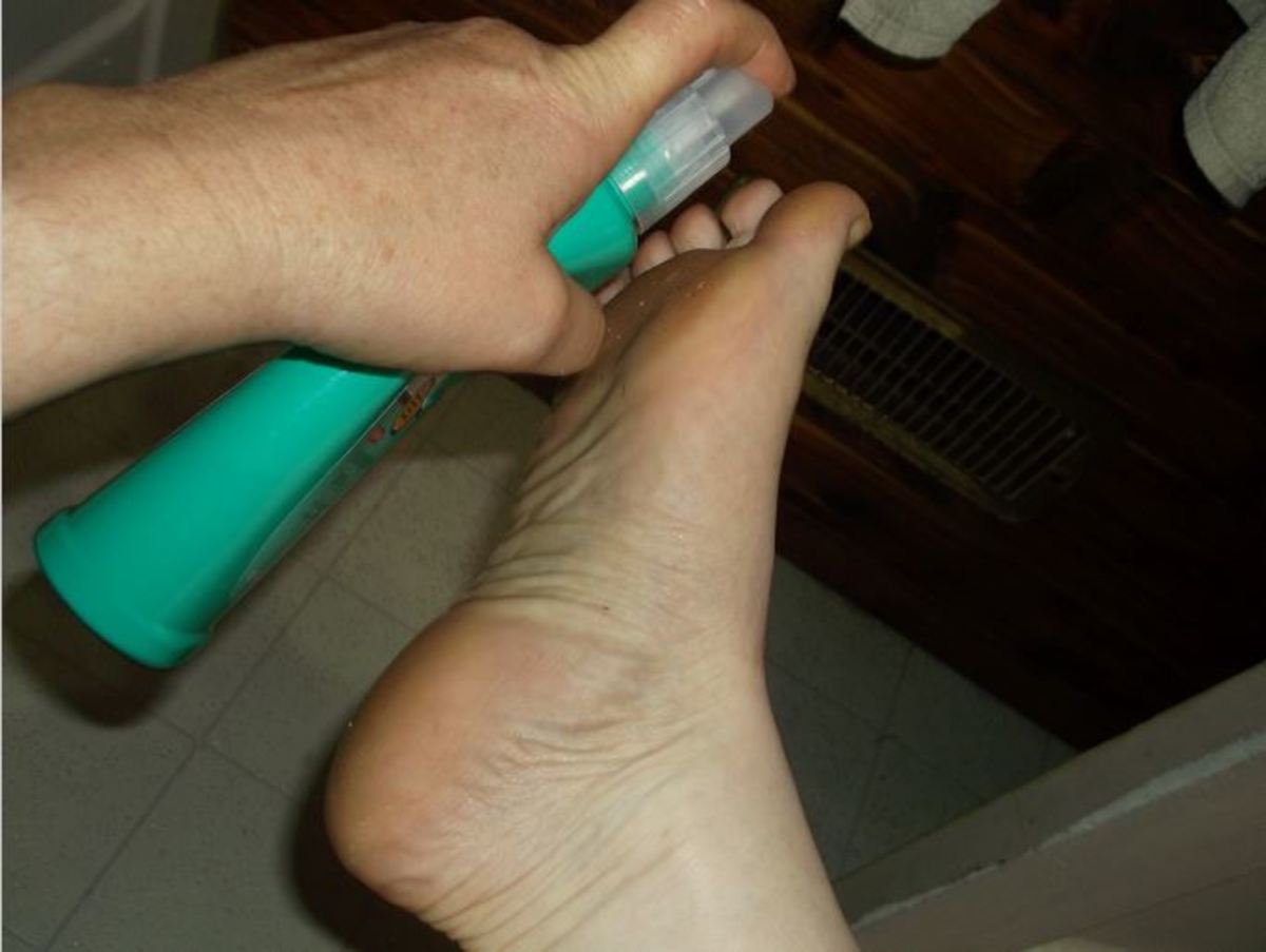 For daily maintenance. I spray my feet with vinegar before I put my socks on.