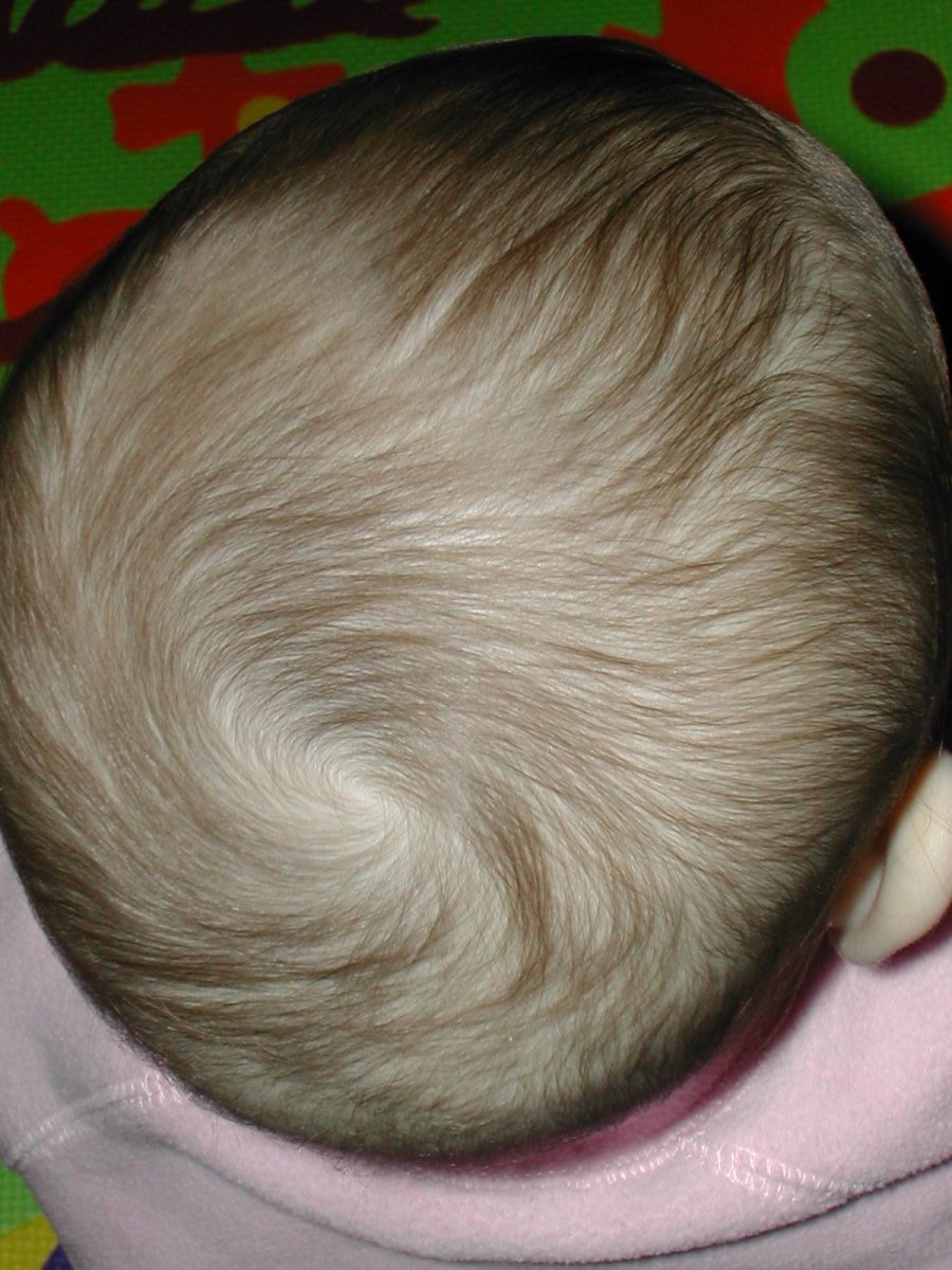 It's fascinating to see how a baby's hair grows.
