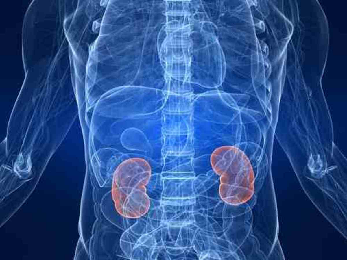 Upside Down Malformed Kidney : Symptoms Treatment and After Care