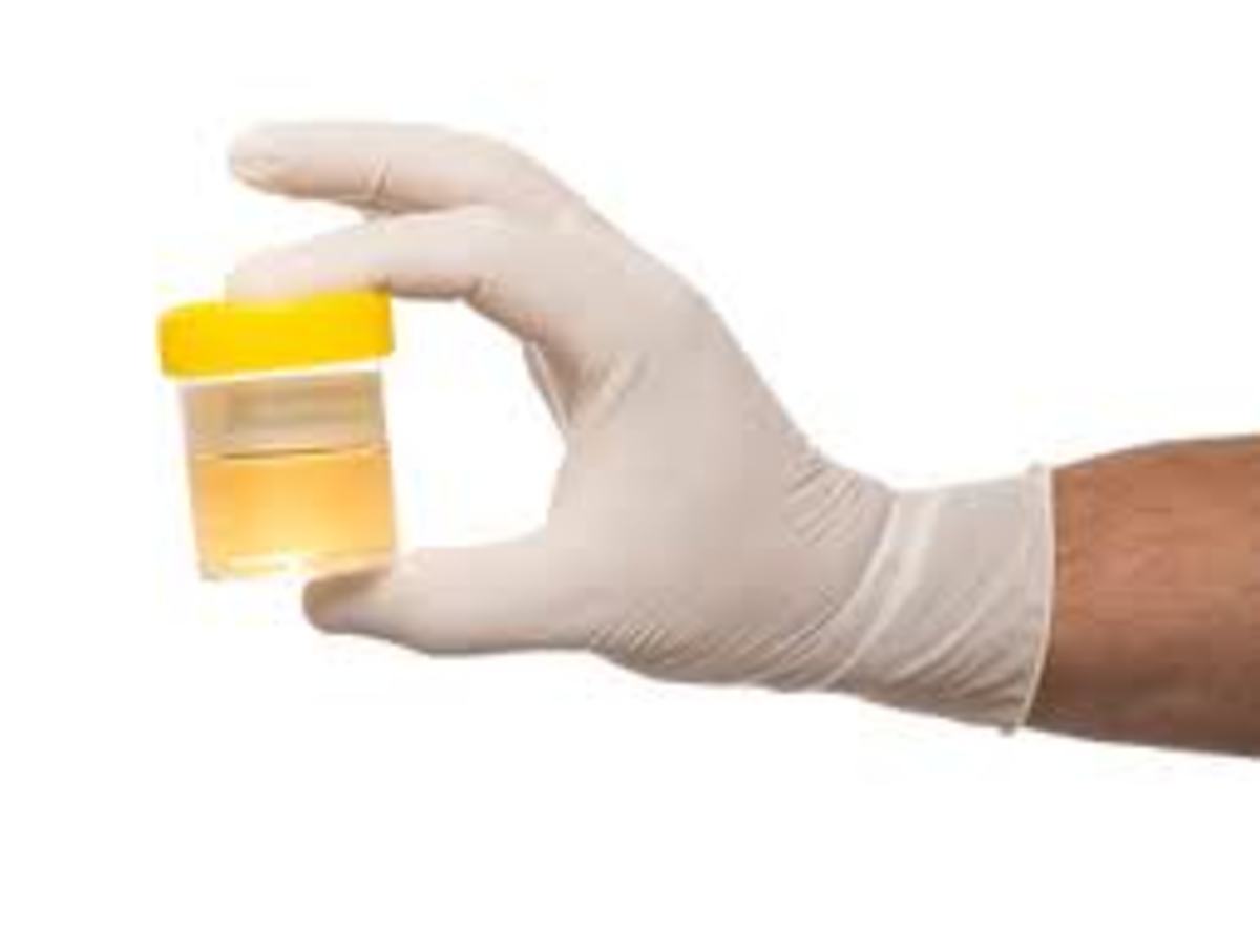 why-would-someone-use-urine-therapy-for-improving-their-health