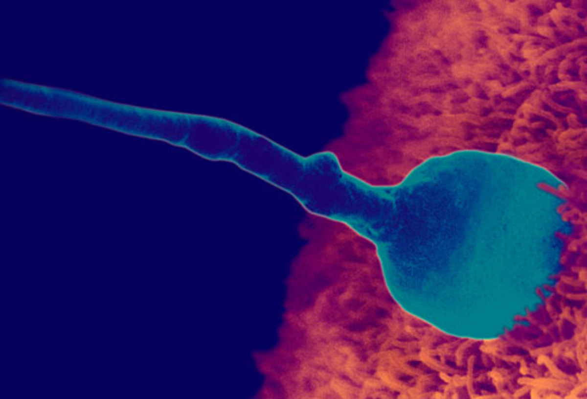 Sperm cell penetrating an Egg resulting in conception