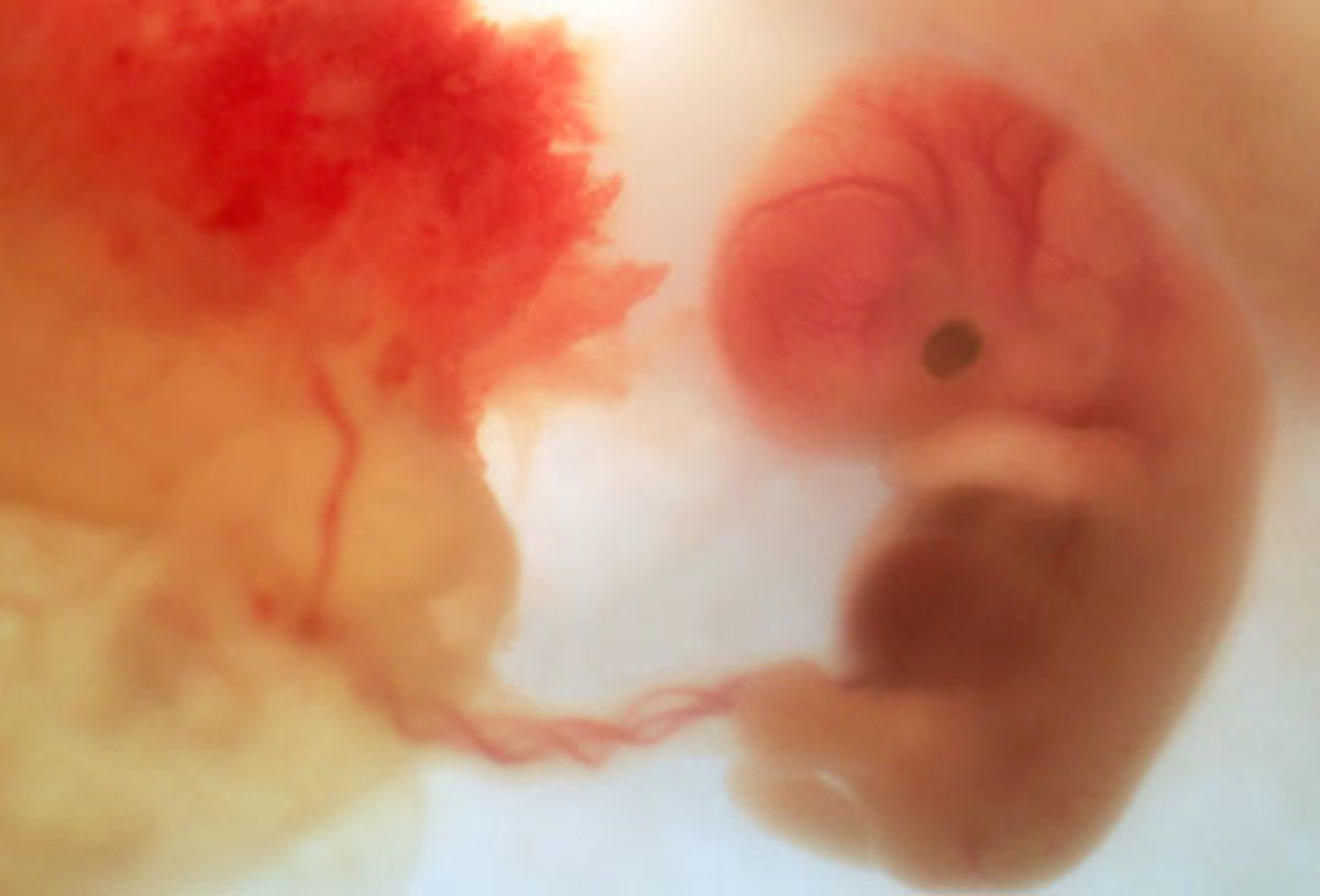 Baby attached to the placenta in the fetus
