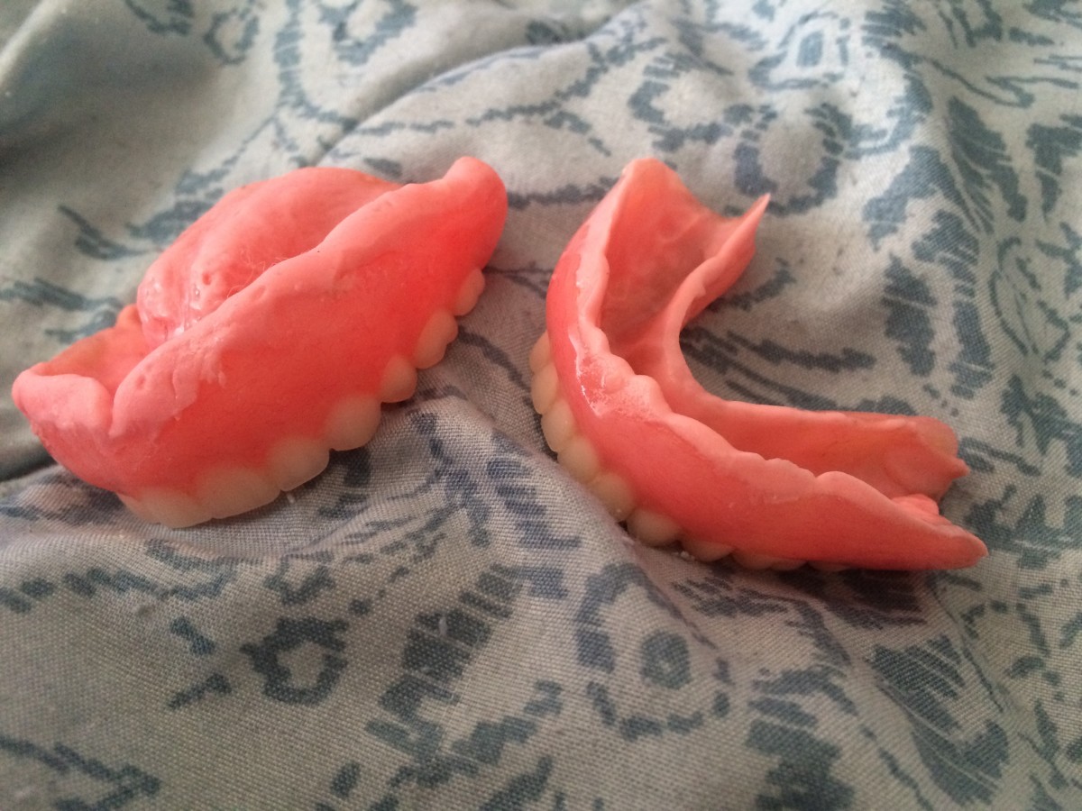My dentures with the soft reline (the light pink material on the top of the dentures). 