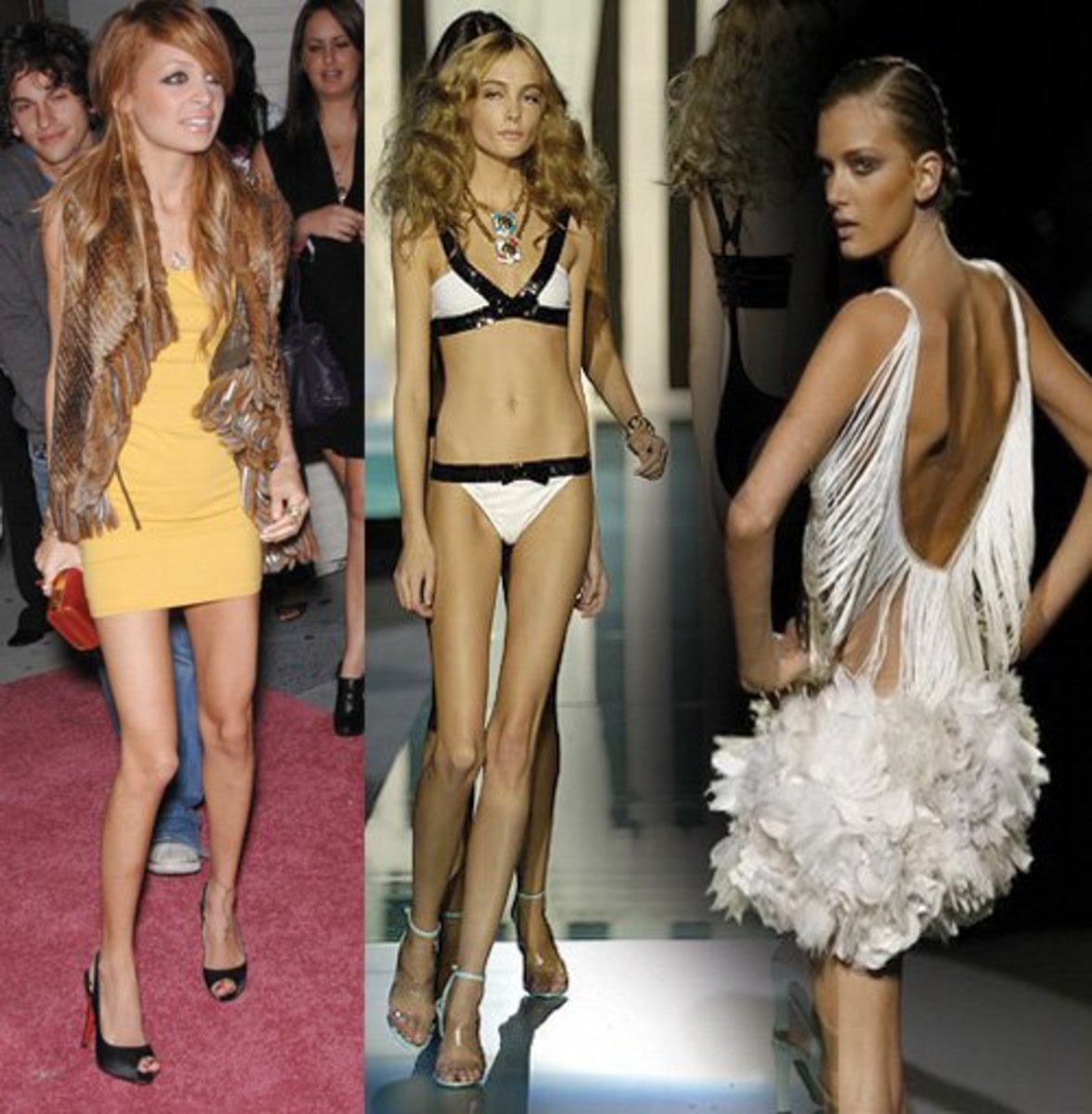 Celebs scary skinny