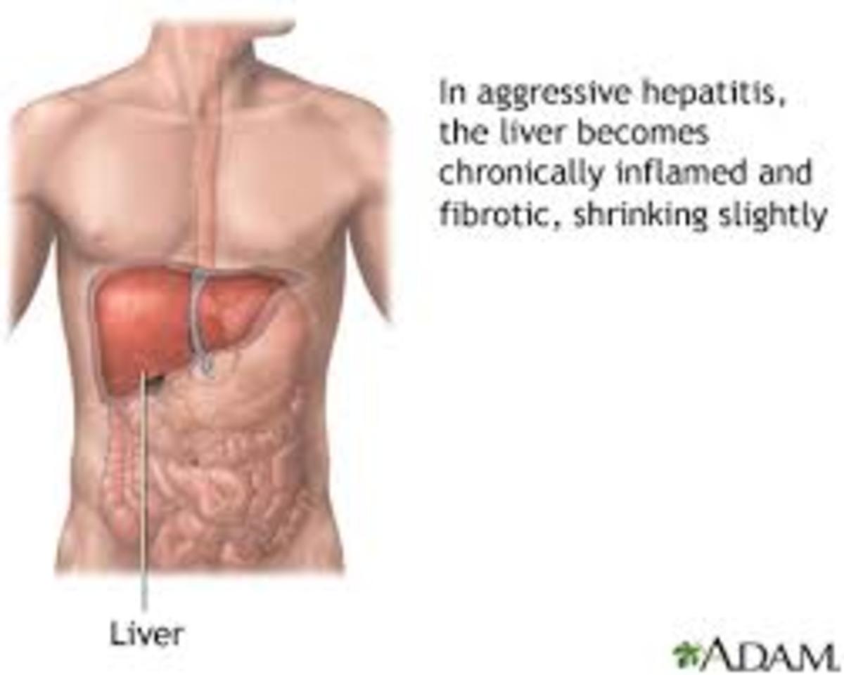 now-a-medical-breakthrough-in-the-control-of-hepatitis-b