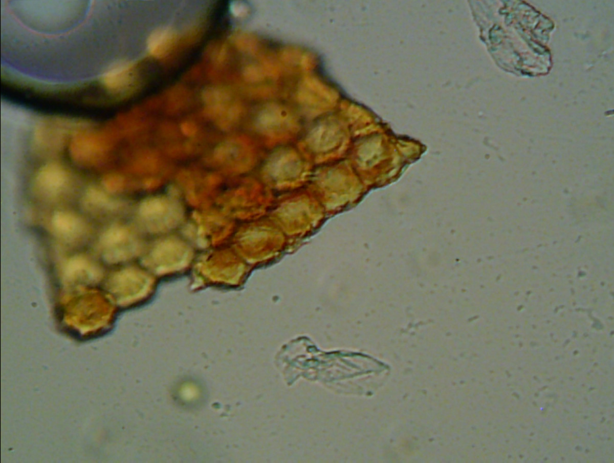 Group of mosquito eggs, flagellate and other bacteria can also be seen.