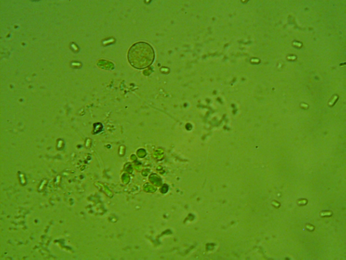 Different types of bacteria, algae