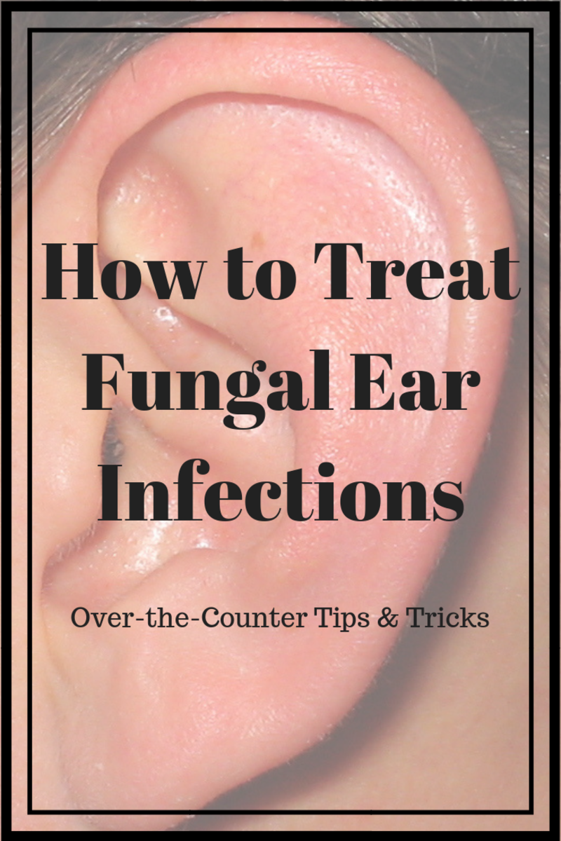 How To Treat Fungal Ear Infections Hubpages