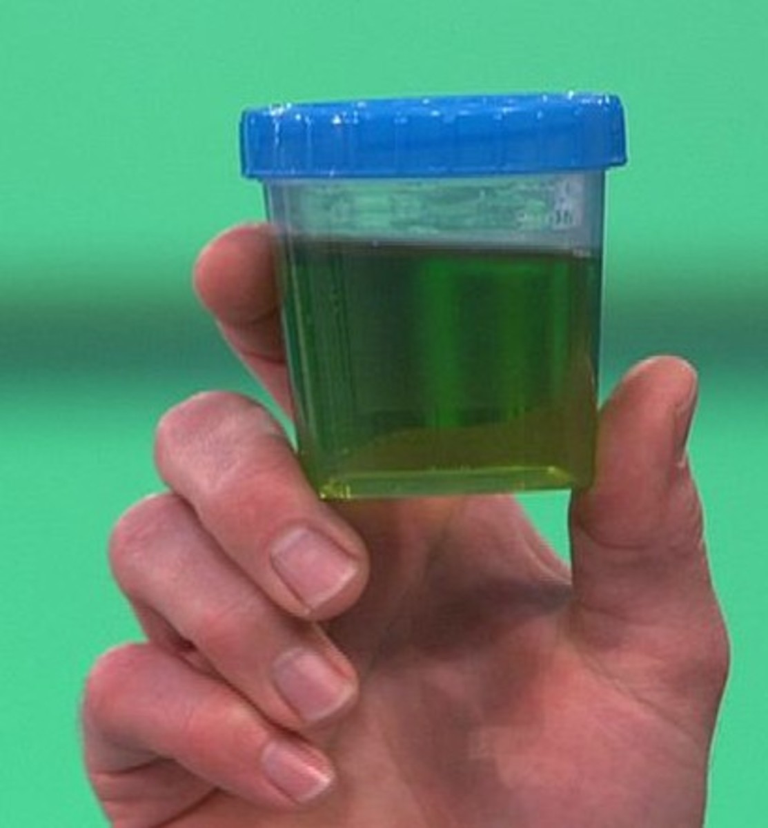 green-urine