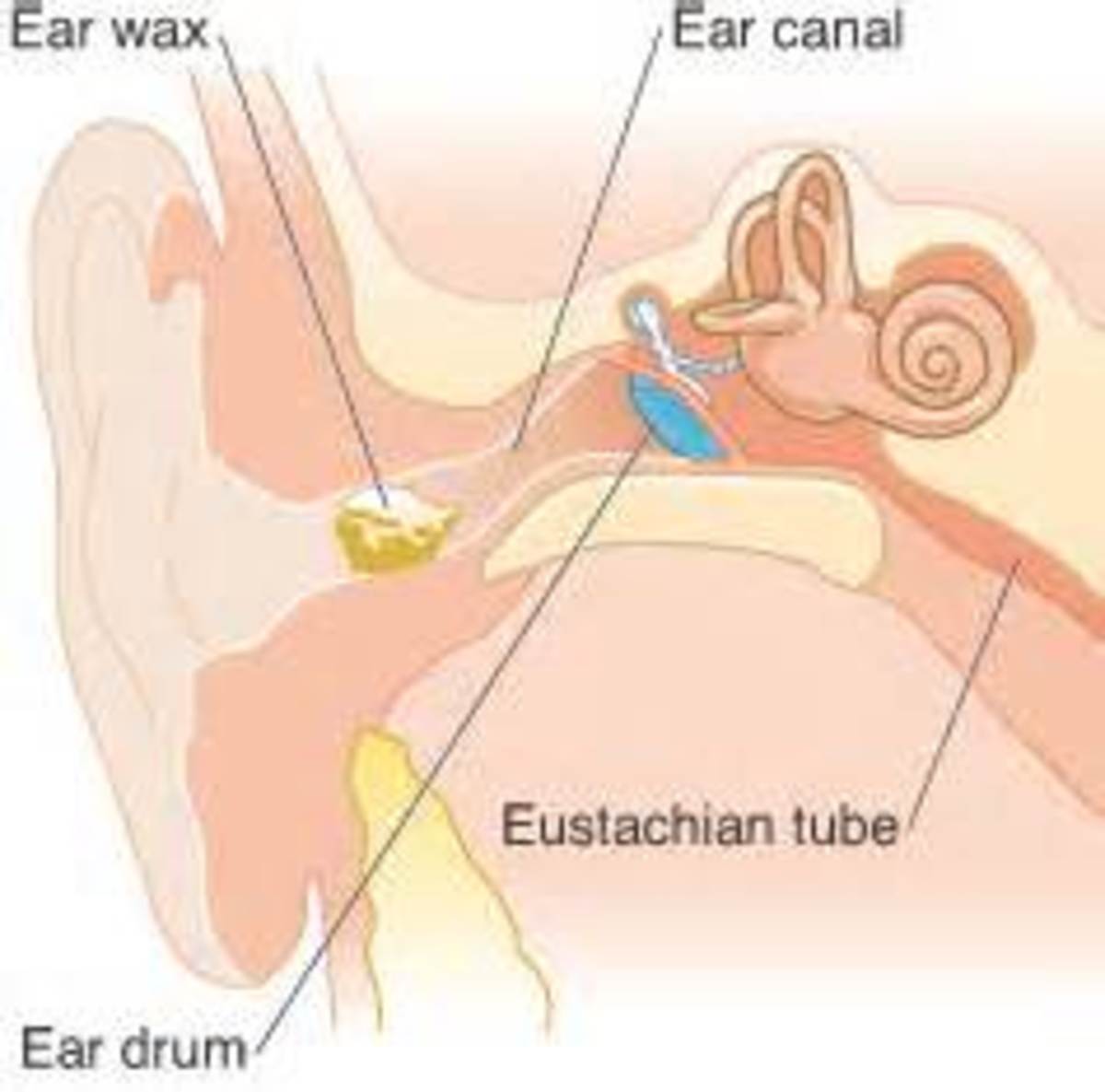 how-to-remove-earwax-or-relieve-an-earwax-impaction-at-home