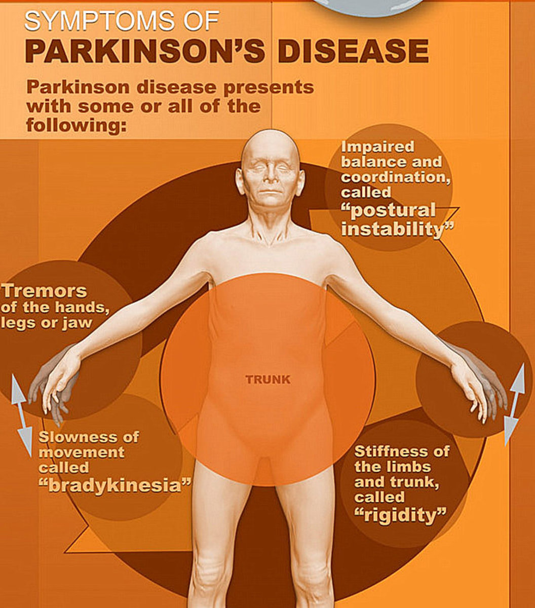 my-parkinsons-disease