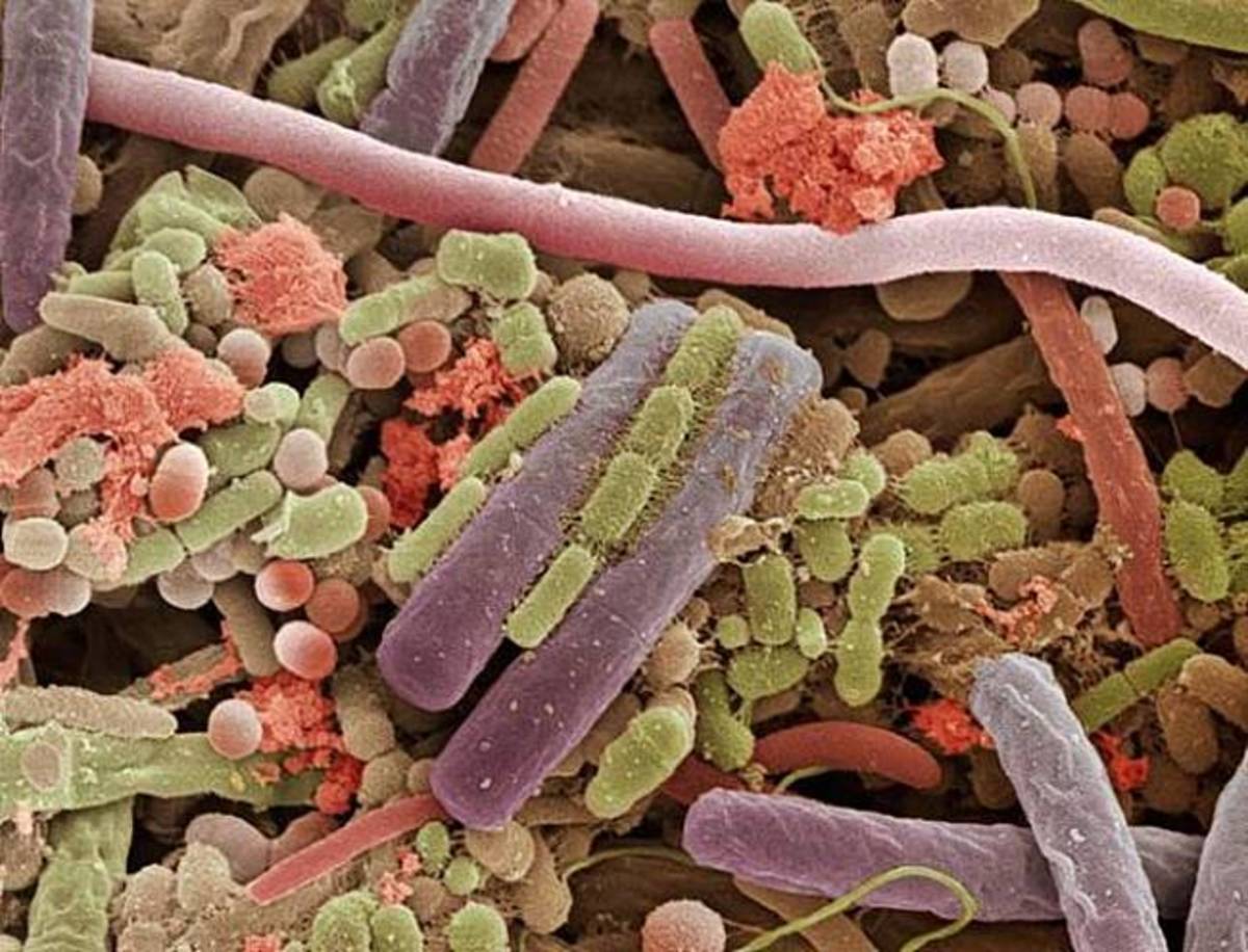 This is an amazing microscopic shot of Bacterial build-up on the Human Tongue.