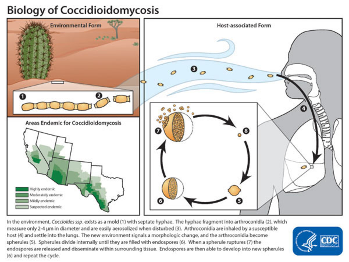 The Life Cycle of the Fungus, Coccidioidomycosis The Life Cycle of the Fungus, Coccidioidomycosis