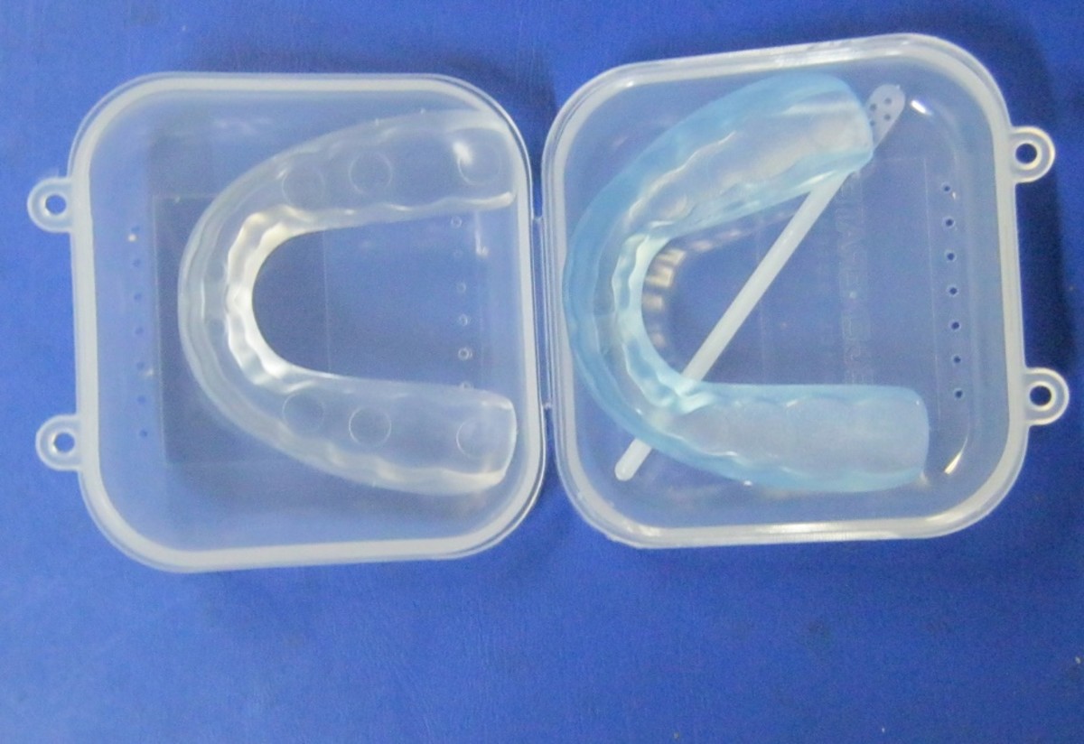 These mouth trays are supposed to be molded to the shape of your mouth.