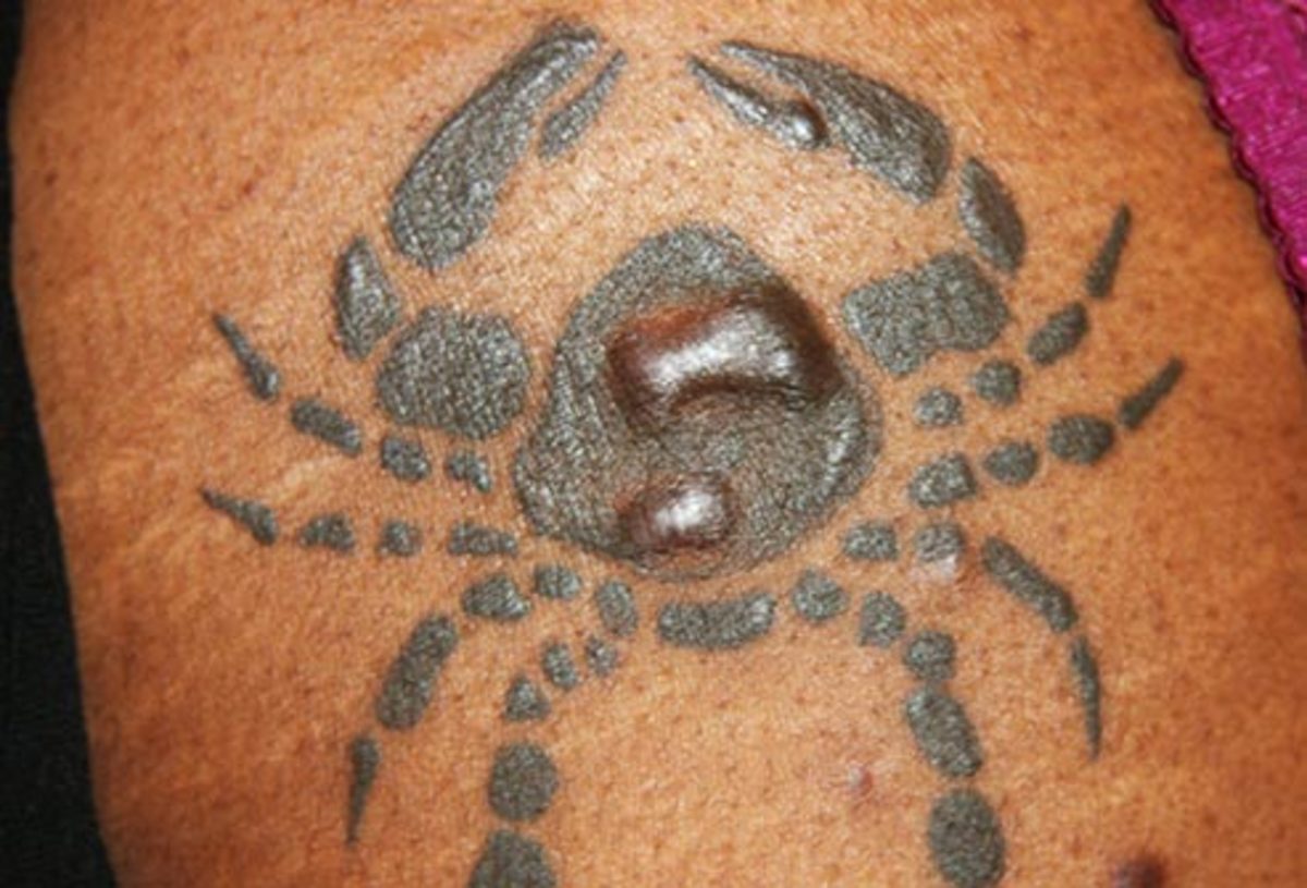 Ten Reasons Why You Should Never Get a Tattoo - HubPages