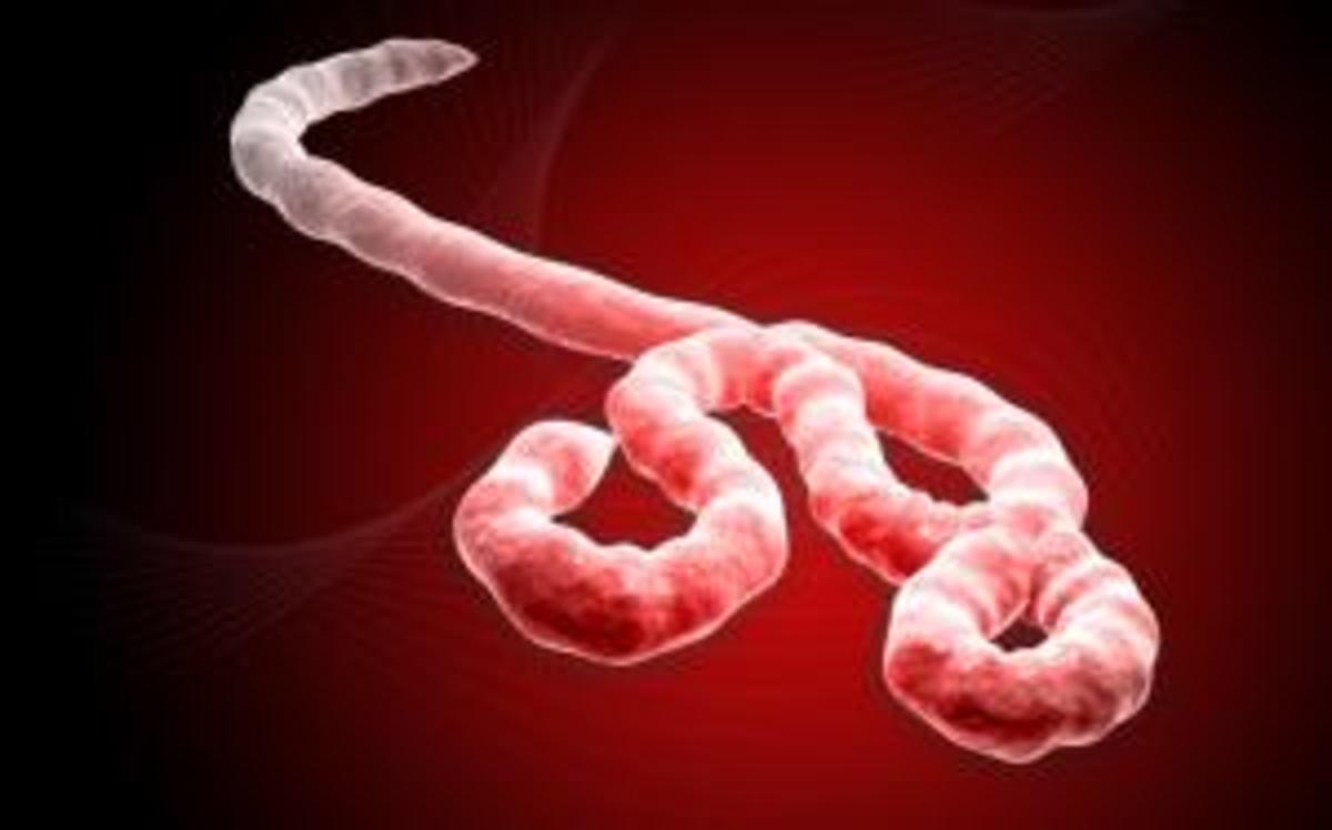 Ebola: Hemorrhagic Disease: The ThirdWorldization Of A Deadly Plague