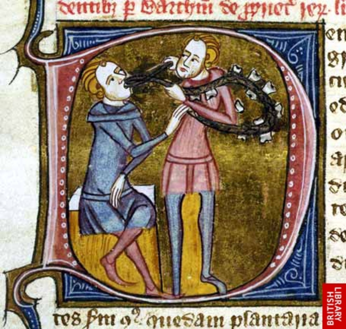 Medieval Illustration of Tooth Extraction showing the mother of all tooth worms!