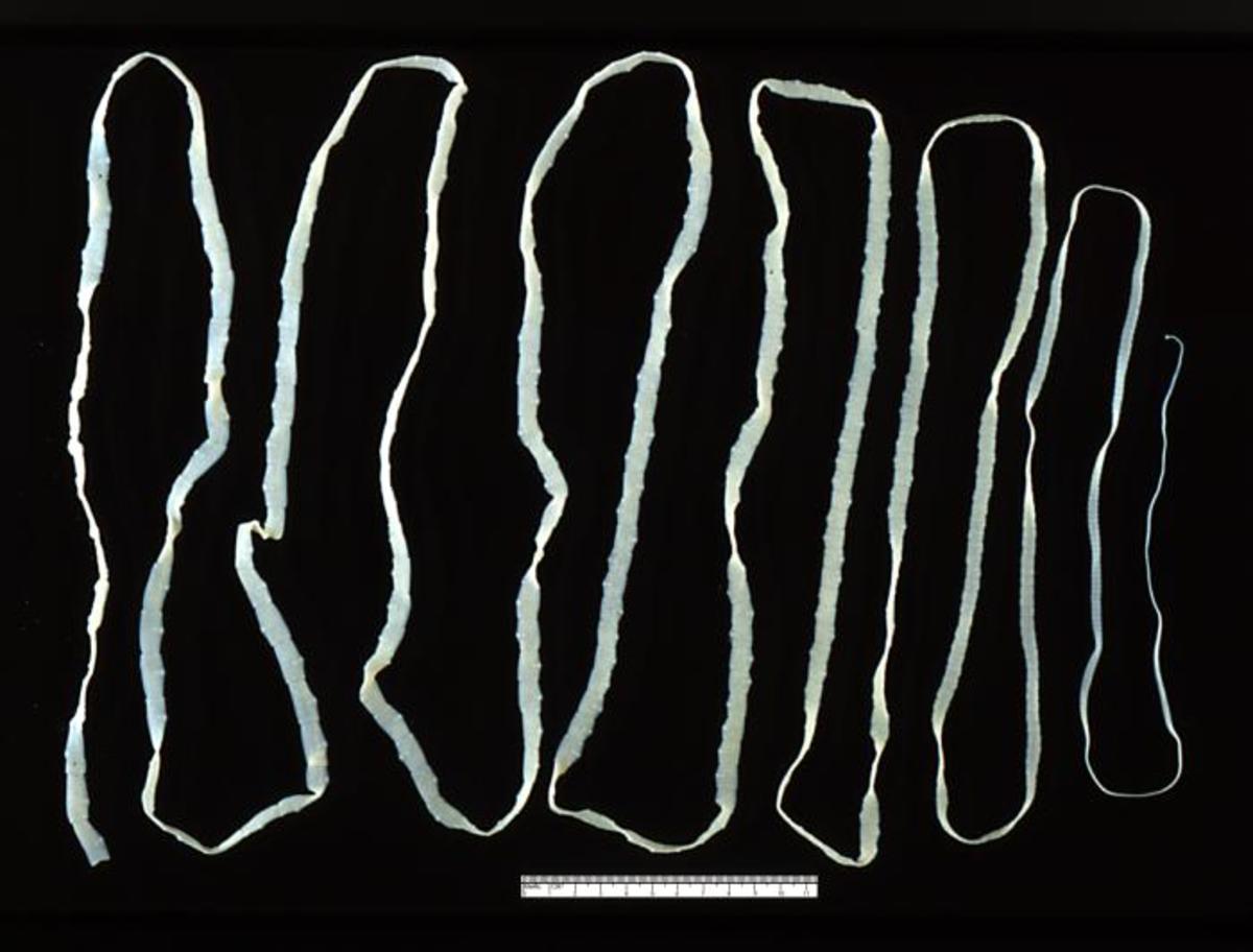 Adult tapeworm (Taenia saginata)