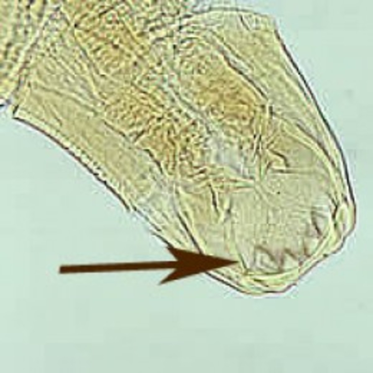 Hookworm mouth (note the hooks)
