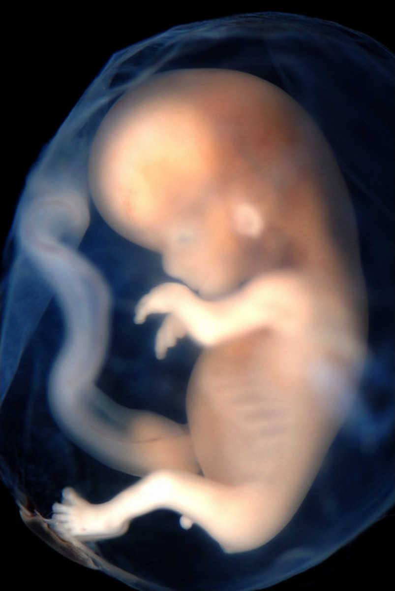 Unborn babies, like this one between 9 and 10 weeks gestation, need protection too!