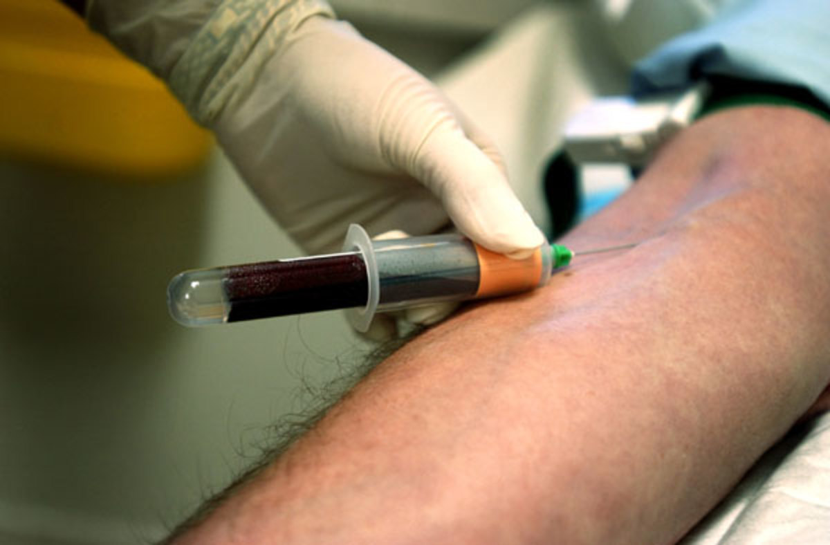 Phlebotomy: How to Draw Blood With Venipuncture