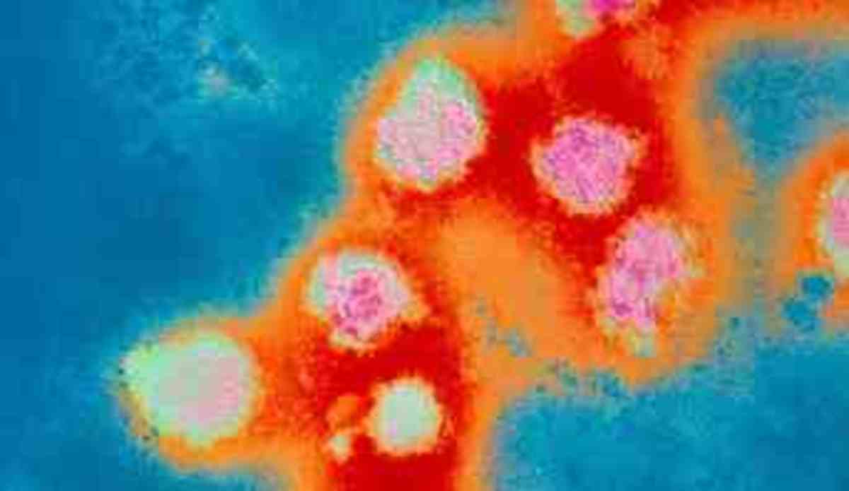 Rubella German measles virus