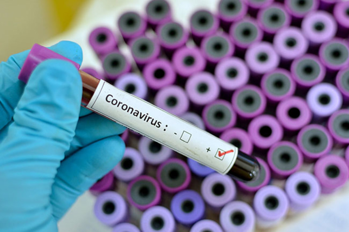 Coronavirus-infections