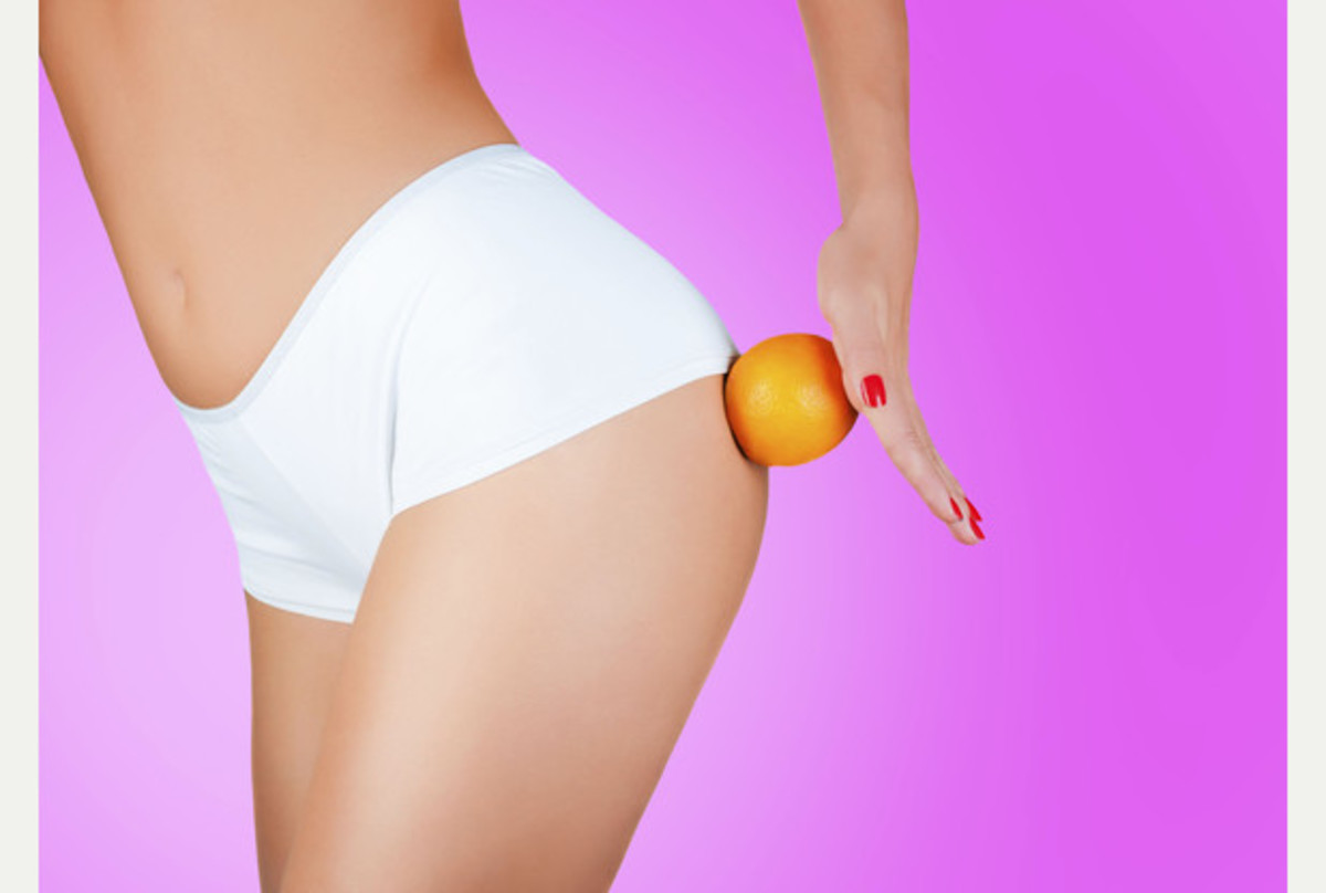 Eat This, Not That to Get Rid of Cellulite