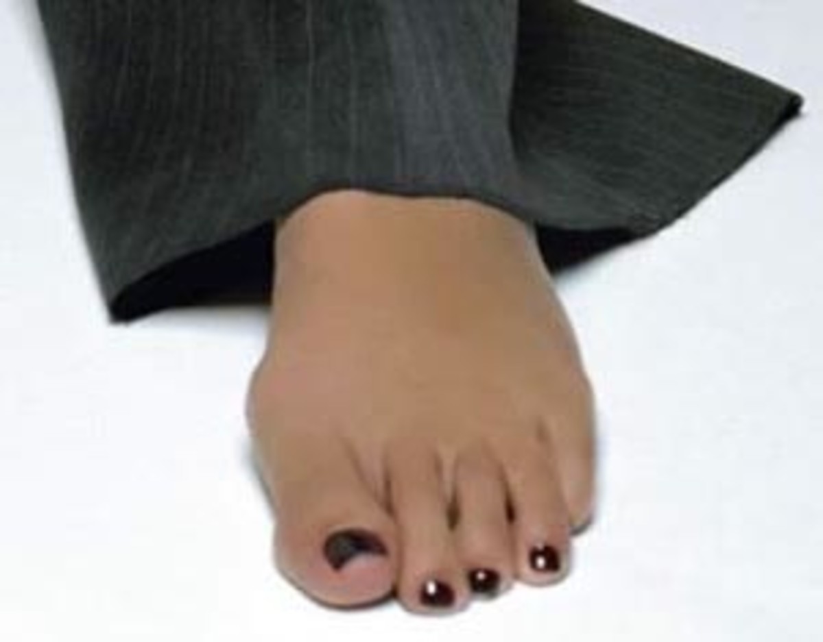 Celebrity Feet Photos Whose Famous Toes Are These Hubpages