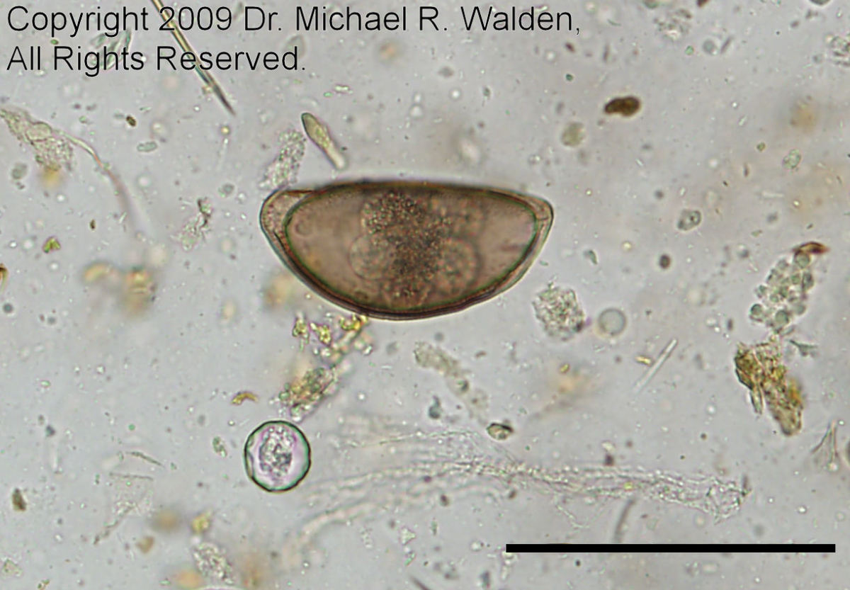Oxyurid ovum with coccidia oocyst of Isospora amphiboluri.  Bar = 100 microns. 200x.  Used with permission.