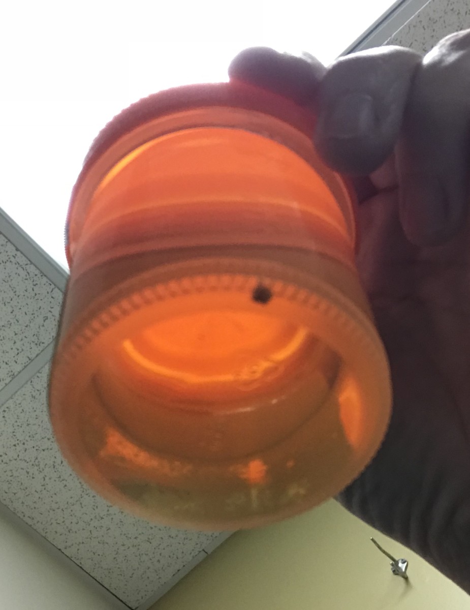 I passed this kidney stone in the emergency room in 2018.