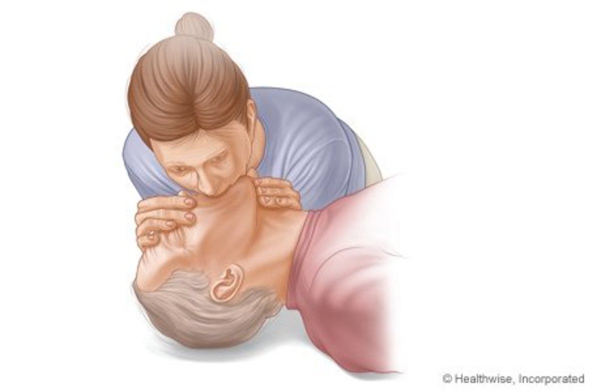 (Fig.3)  courtesy of firstaid.webmd.com