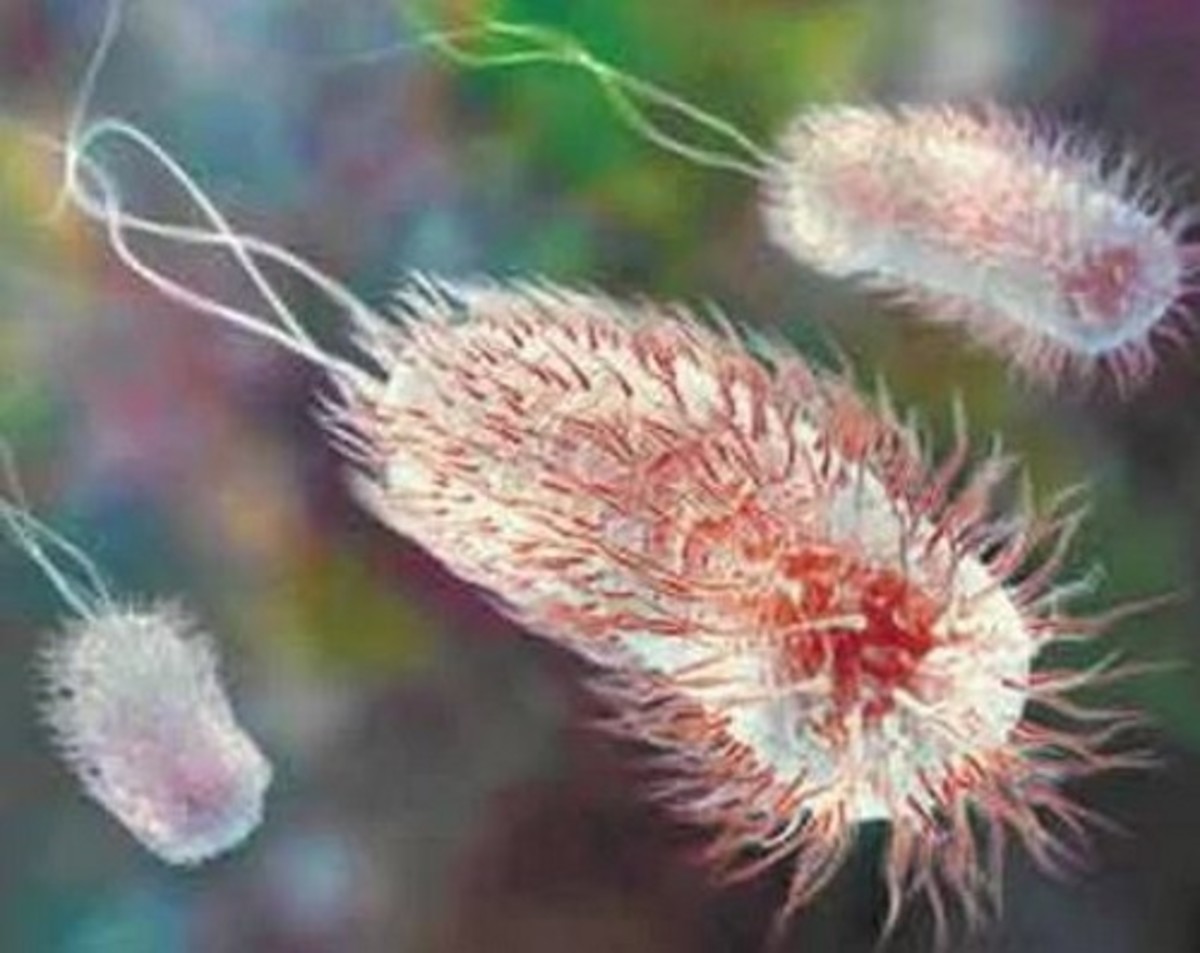E. coli bacteria can cause food poisoning